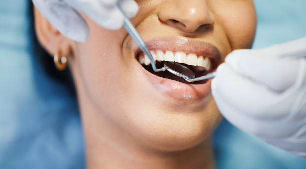 Best Emergency Treatment for Oral Infections in Saginaw, TX